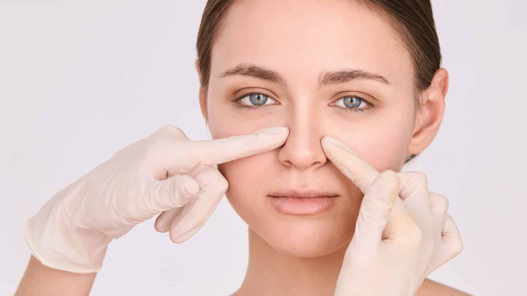 When Can I Revise My Rhinoplasty Safely?