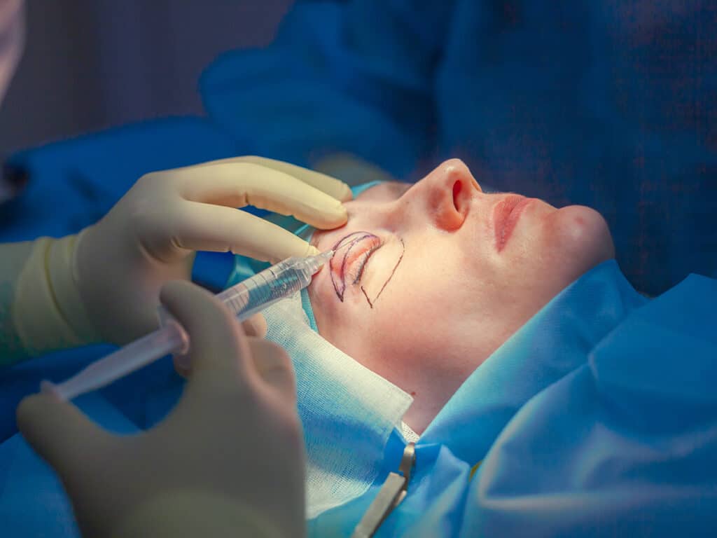Liquid facelift procedure for a woman
