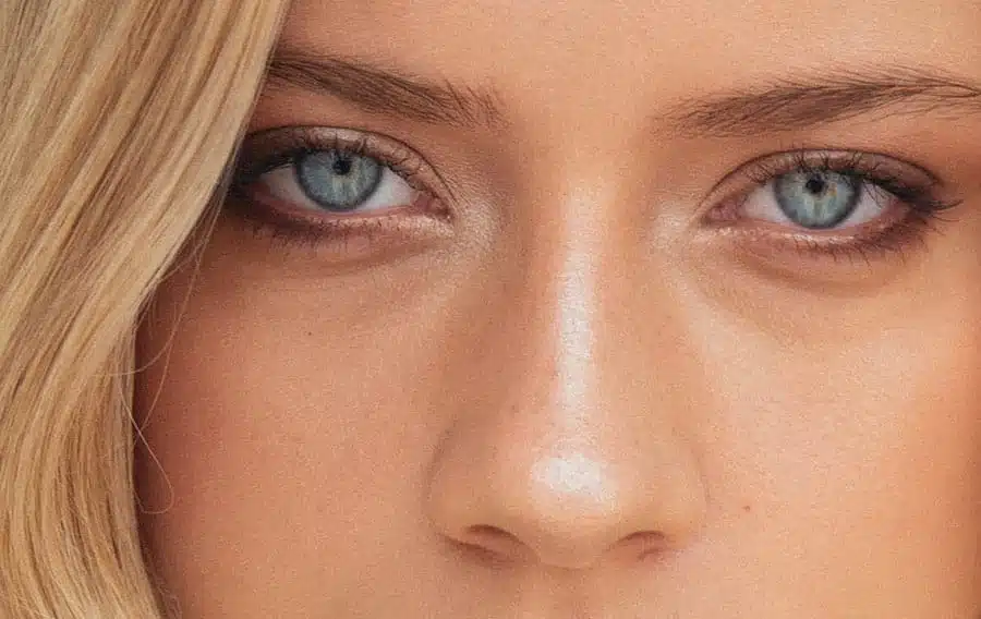 Plastic surgery for the eyes | Dr. Andrew Frankel