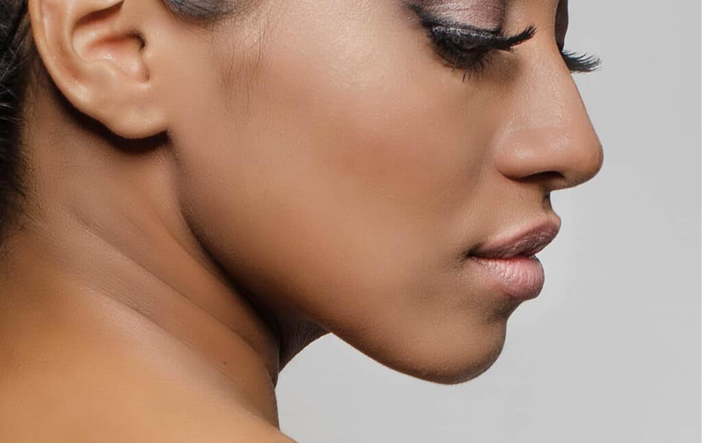 Jawline Contouring in Beverly Hills, CA