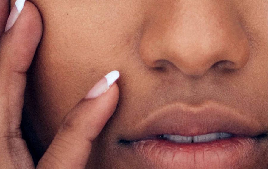 A lip lift shortens the distance between the base of the nose and the upper lip.