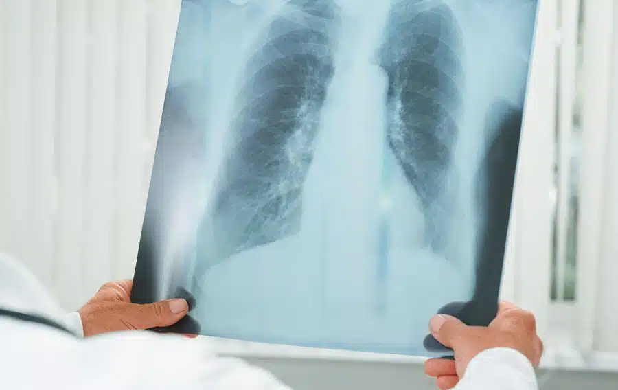 Patients over 65 will also require an X-ray.