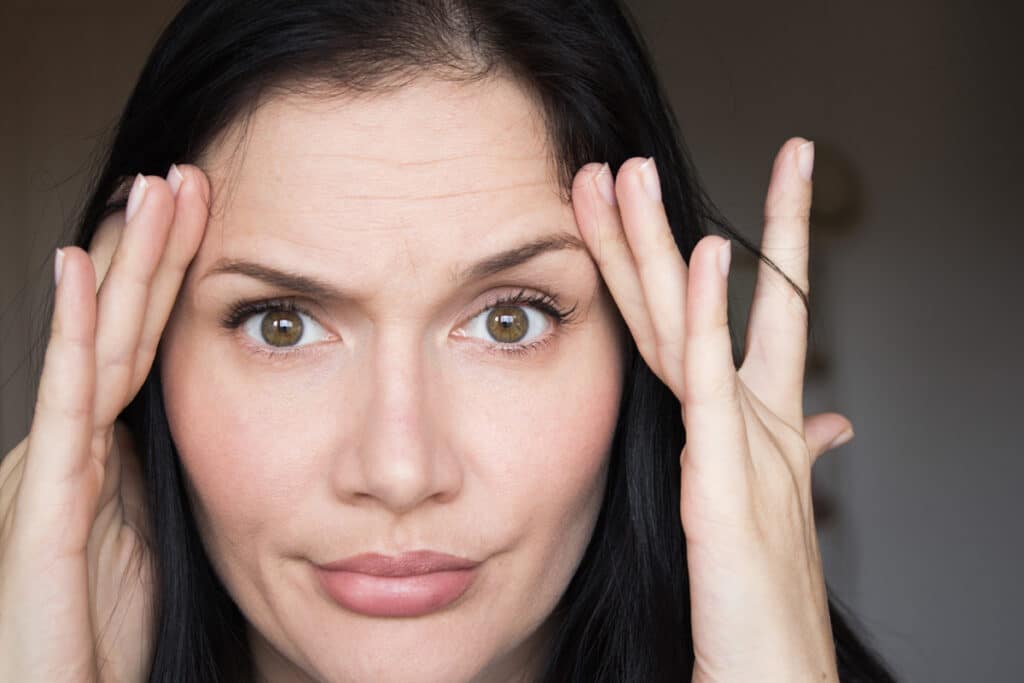 One of the benefits of a mini brow lift is the shorter recovery time, allowing patients to resume normal activities sooner.