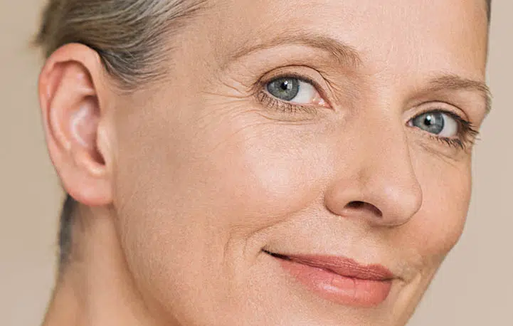 Mature woman with smooth, glowing skin demonstrating the results of laser skin rejuvenation treatment.