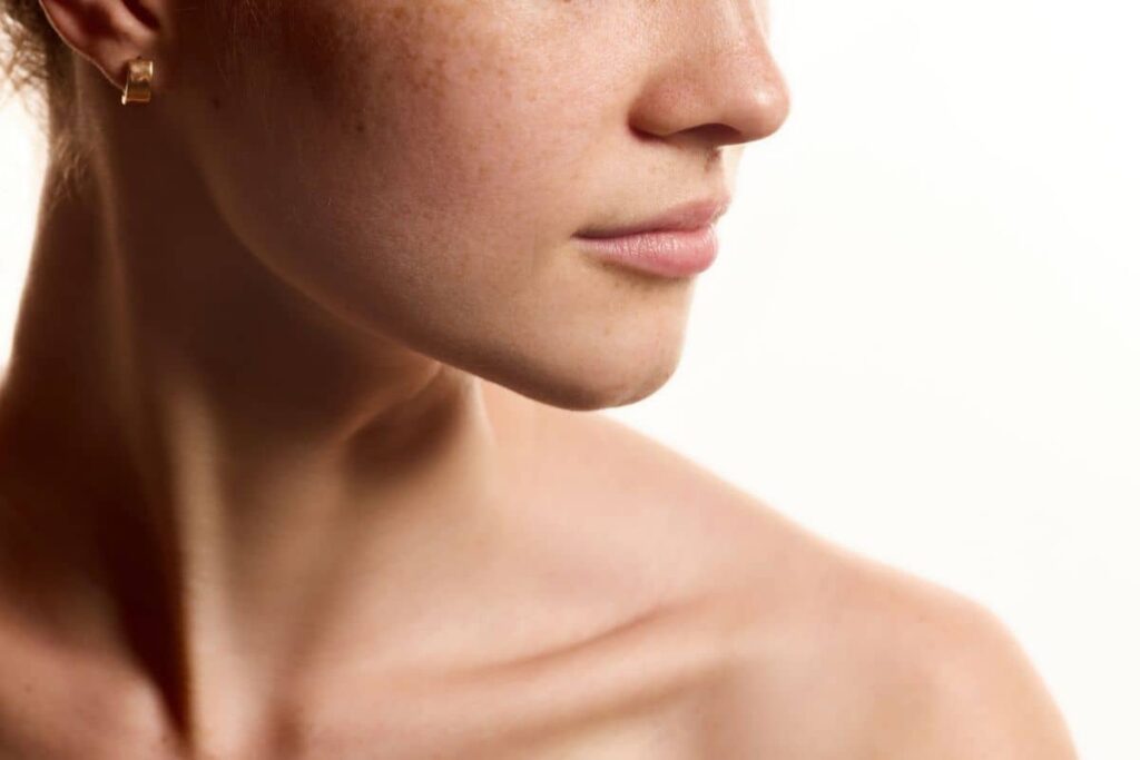 Close-up of defined chin and jawline on woman, illustrating refined facial balance from jawline contouring surgery.